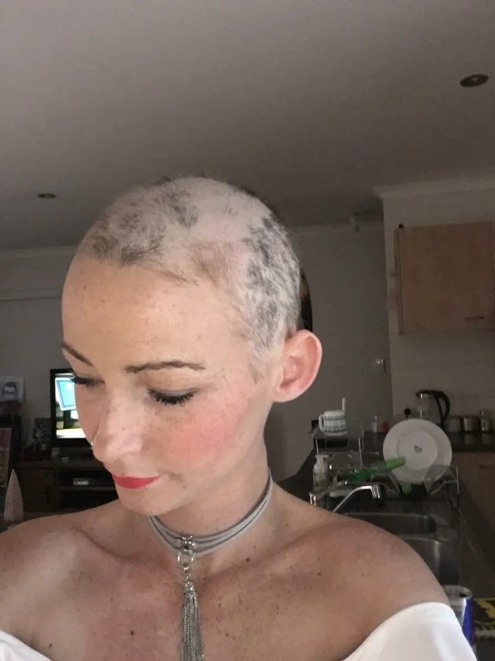 Queensland woman’s cancerous tumour turns out to be baby