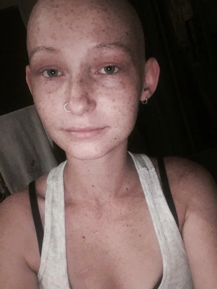 Queensland woman’s cancerous tumour turns out to be baby