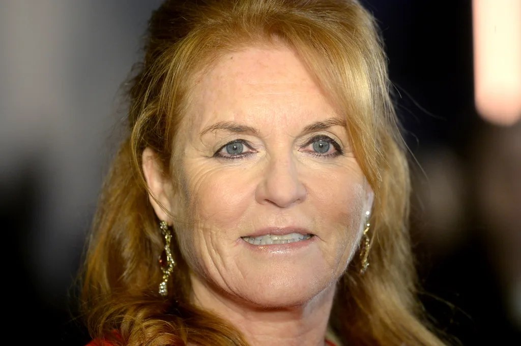 Sarah Ferguson's new face after admitting to numerous cosmetic procedures