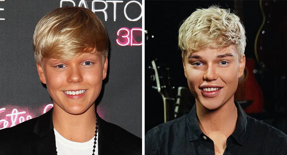 Jack Vidgen before and after