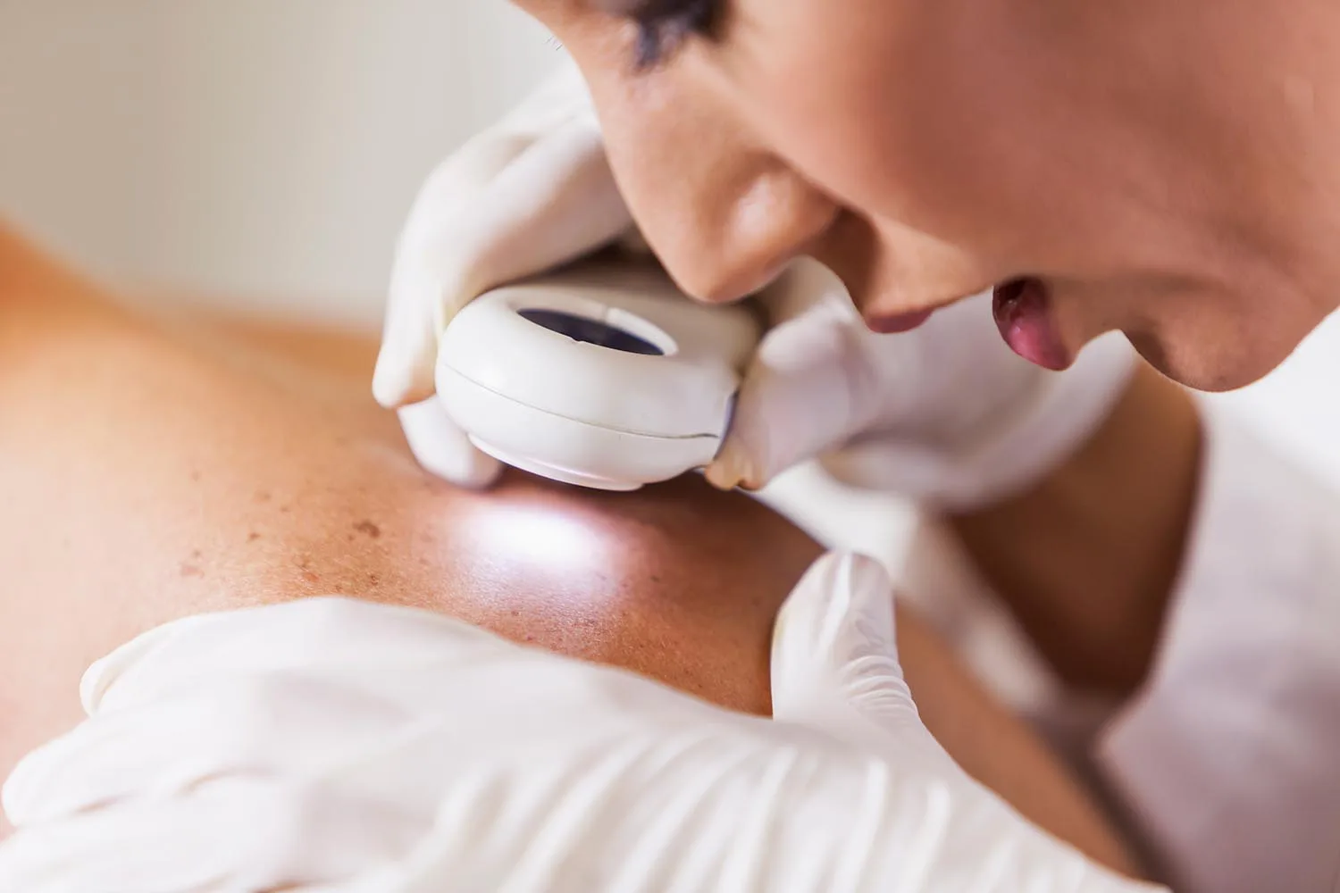 dermatologist checking skin
