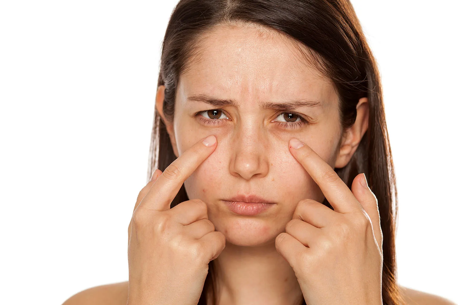 How to get rid of bags under eyes