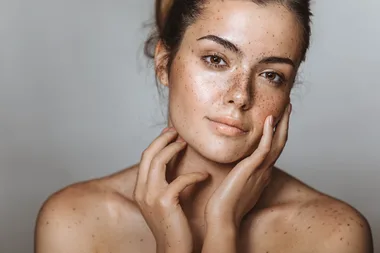 5 of the most common skin care issues and how to solve them