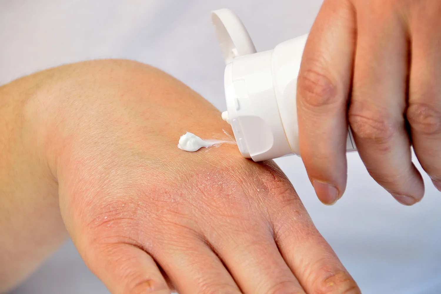 applying cream to hand