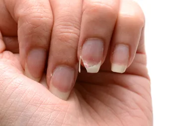 How to fix a broken nail in 5 minutes