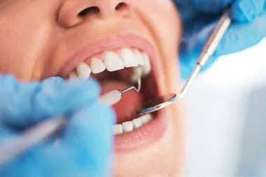 5 things your mouth says about your health