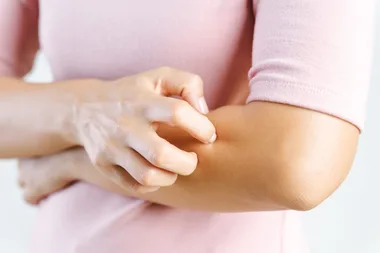 Study finds why mosquitoes bite some people more than others