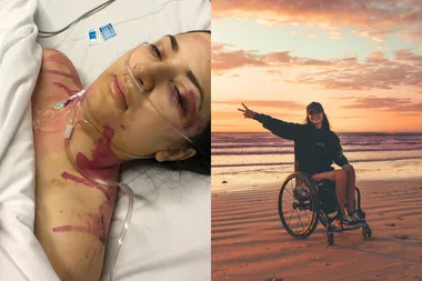 Woman pictured in hospital straight after freak accident and after photo after recovery living in a wheelchair