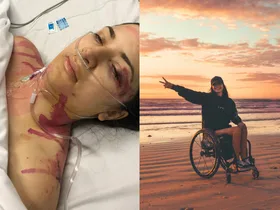 Woman pictured in hospital straight after freak accident and after photo after recovery living in a wheelchair