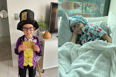 Before and after photo of boy recovering in hospital and dressed as Willy Wonka