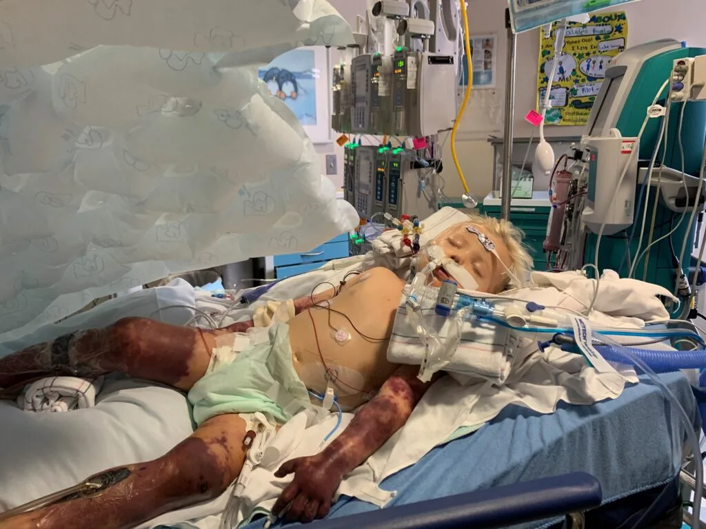 Photo of toddler fighting for his life in hospital