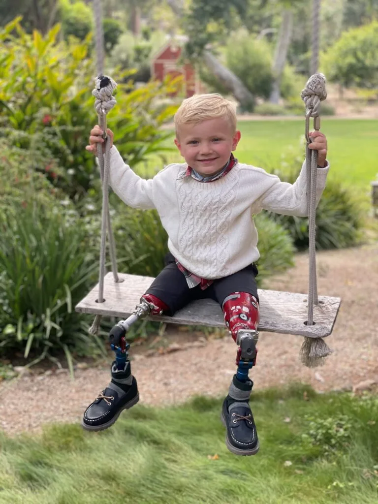 Photo of ampute toddler sitting on swing