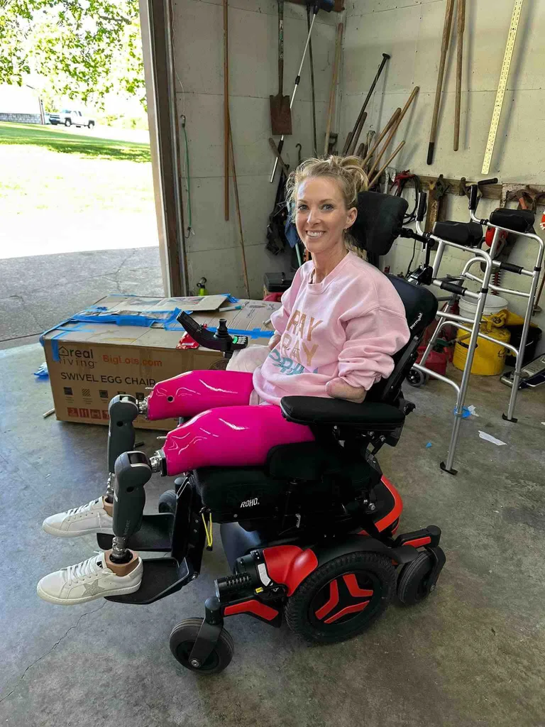 Image of woman wearing her pink leg prosthetics