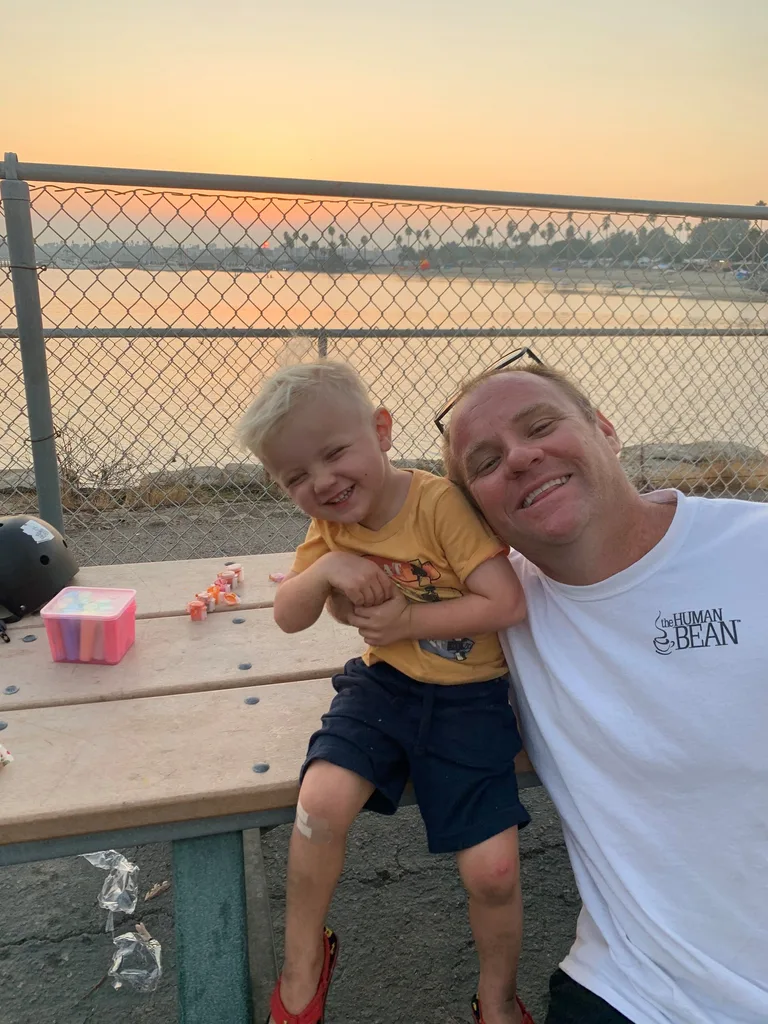 Picture of toddler with scraped knee pictured with dad on holiday