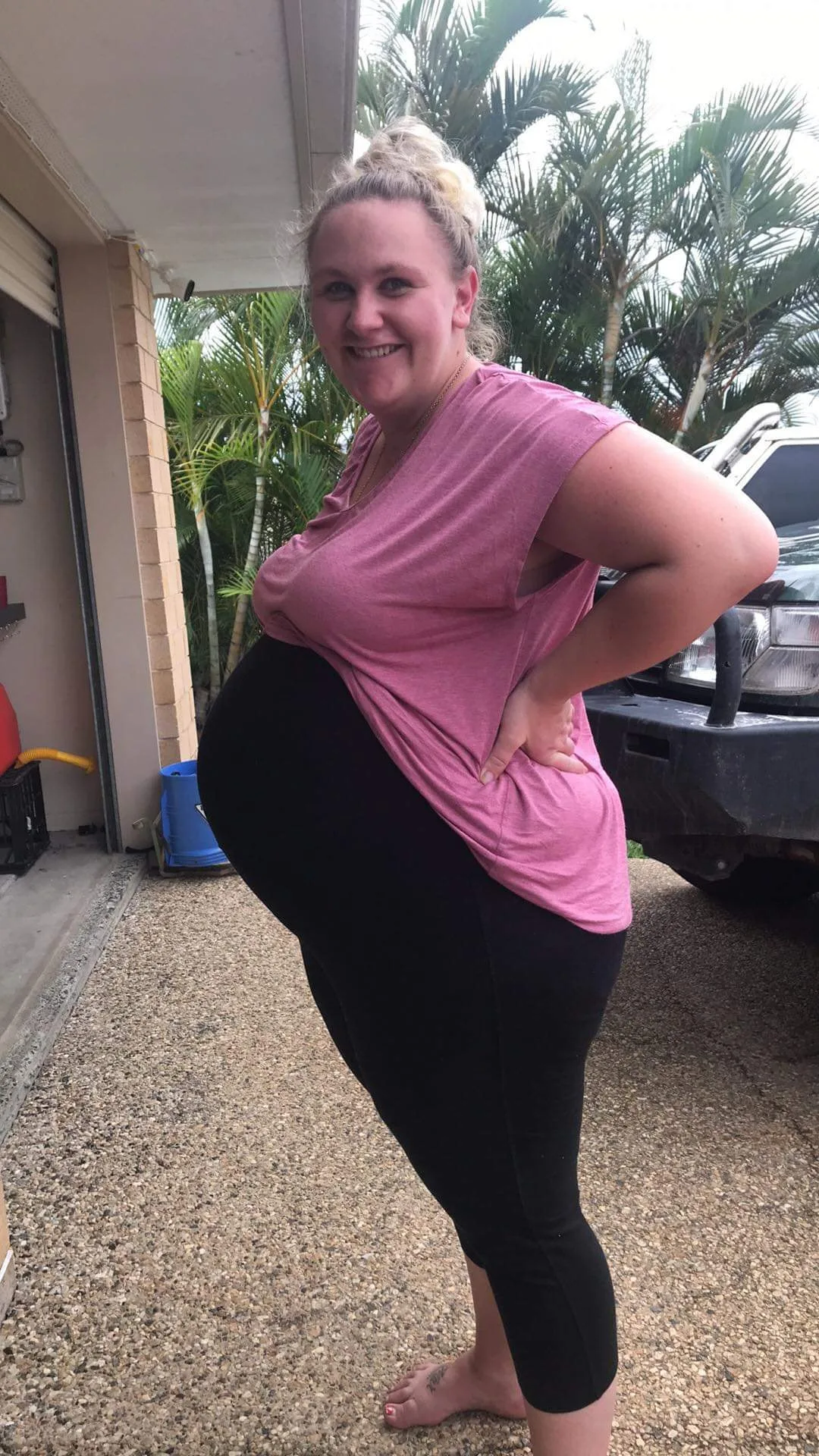 Image of woman pregnant with triplets