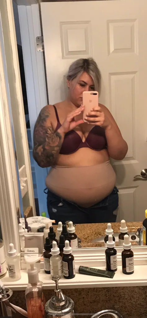 Ali Bruch before weight loss