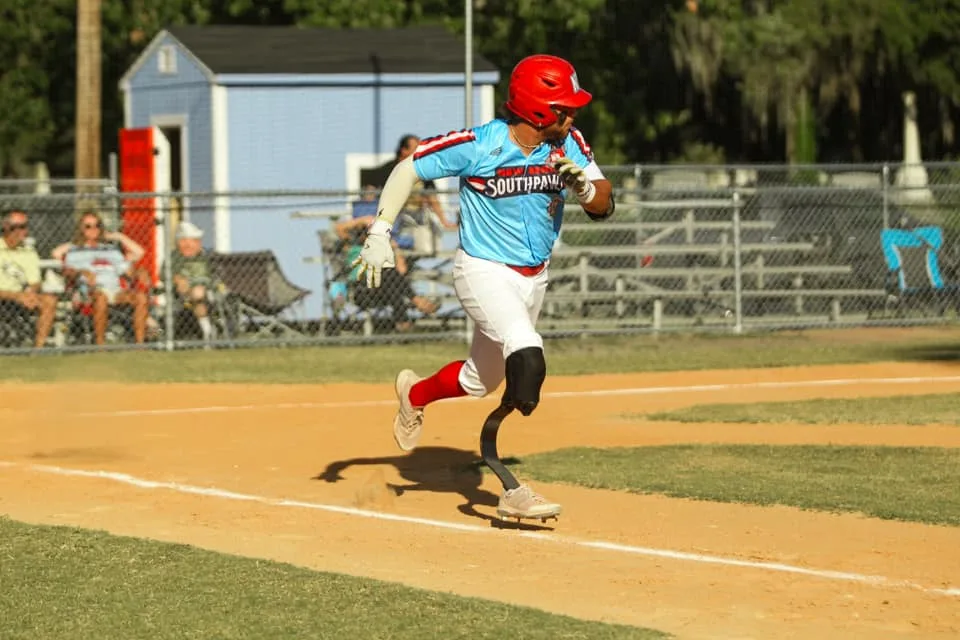 Image of guy playing baseball with prosthetic