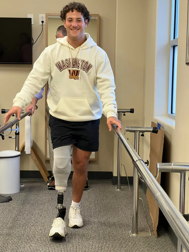 Image of guy in rehab after losing his leg