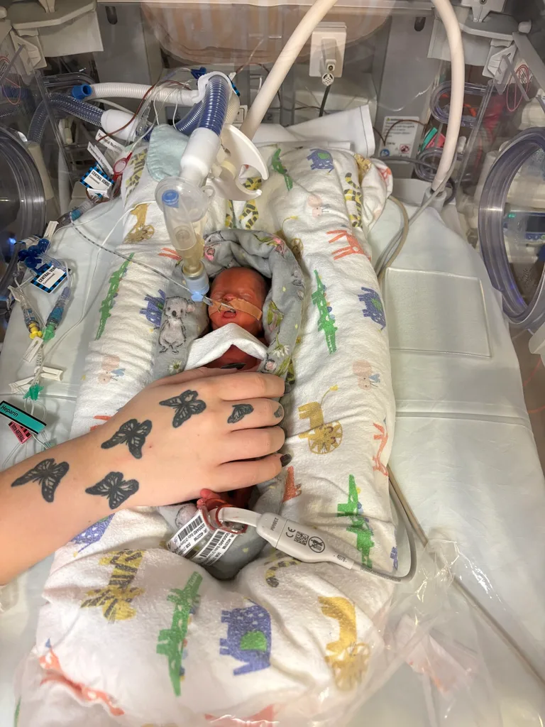 Image of newborn premmie baby in hospital