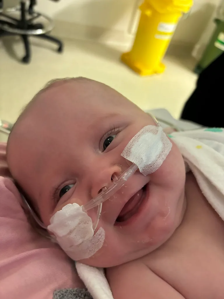 Image of smiling baby with breathing tube