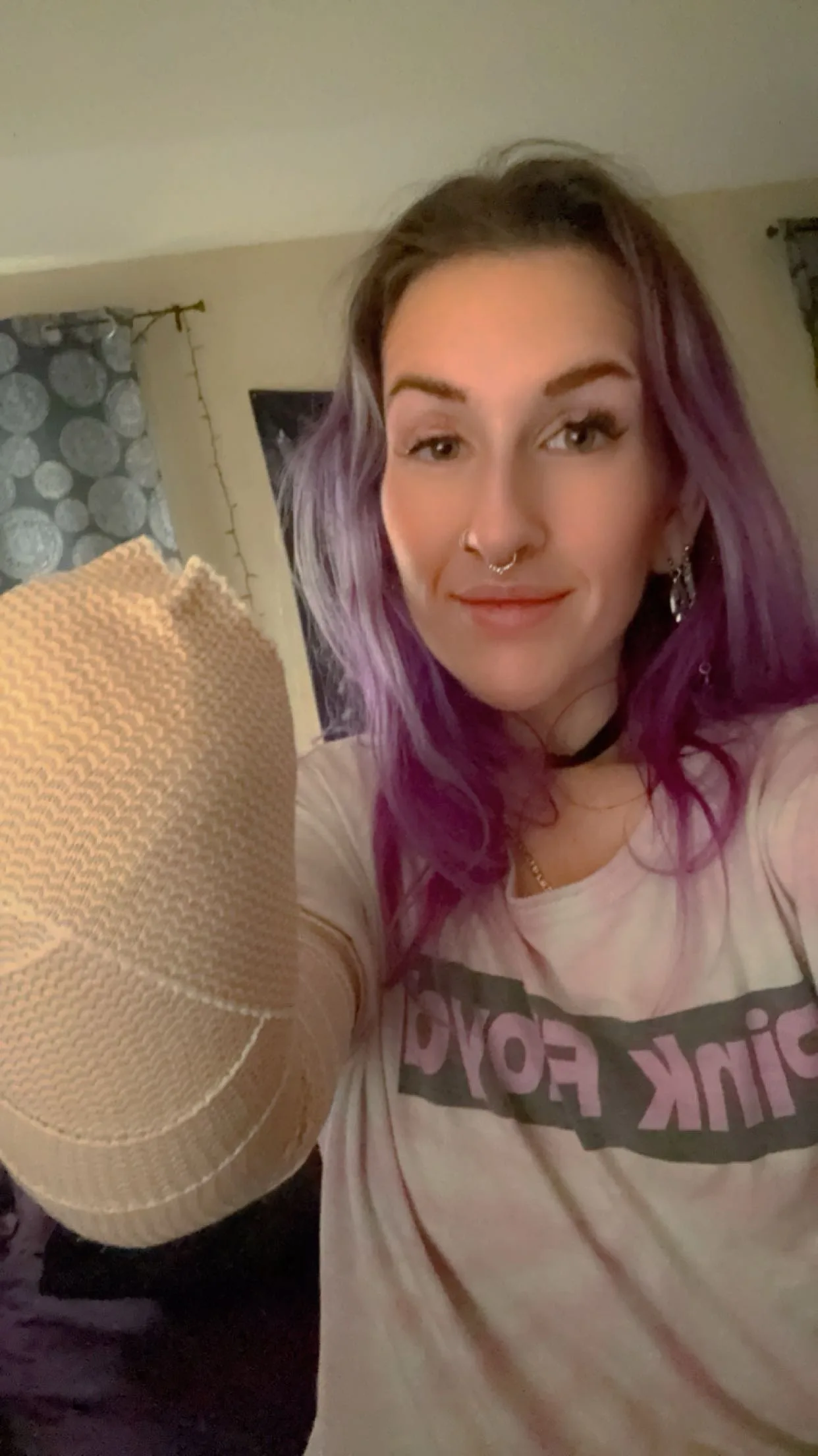 Image of woman with purple hair showing amputated hand