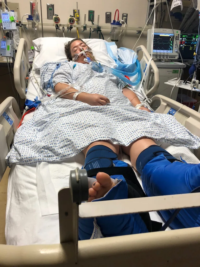 Image of woman recovering in hospital post jetski accident