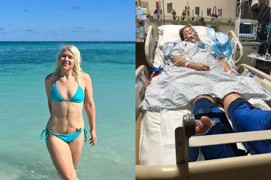 Images of woman post jetski accident