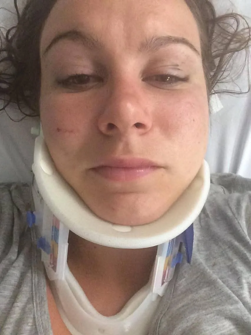 A selfie of Libby in hospital. She has bruising on her face.