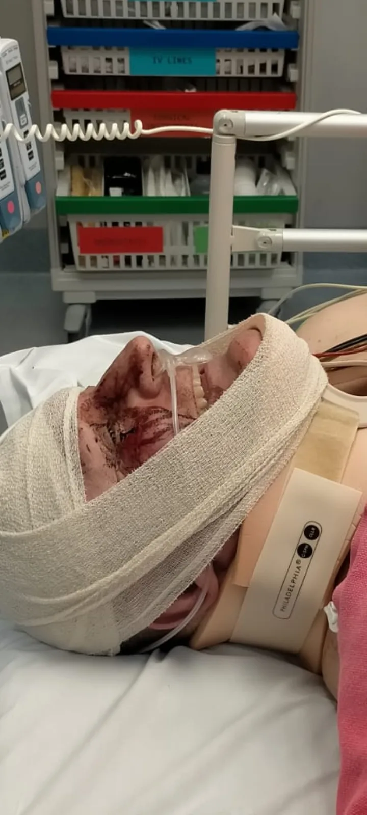 man with bloodied bandaged head 