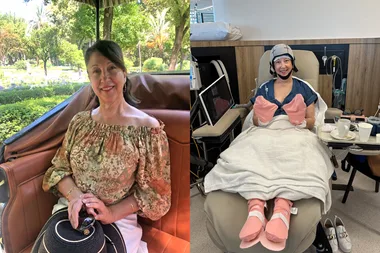 Before and after photos of woman receiving chemo