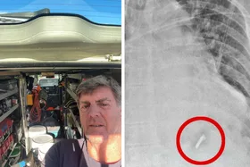 Nail gun accident: A nail hit my heart!