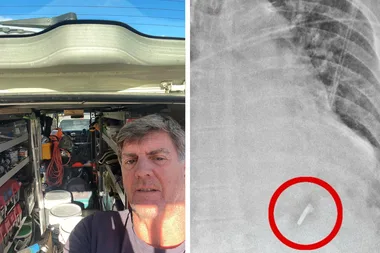 Nail gun accident: A nail hit my heart!