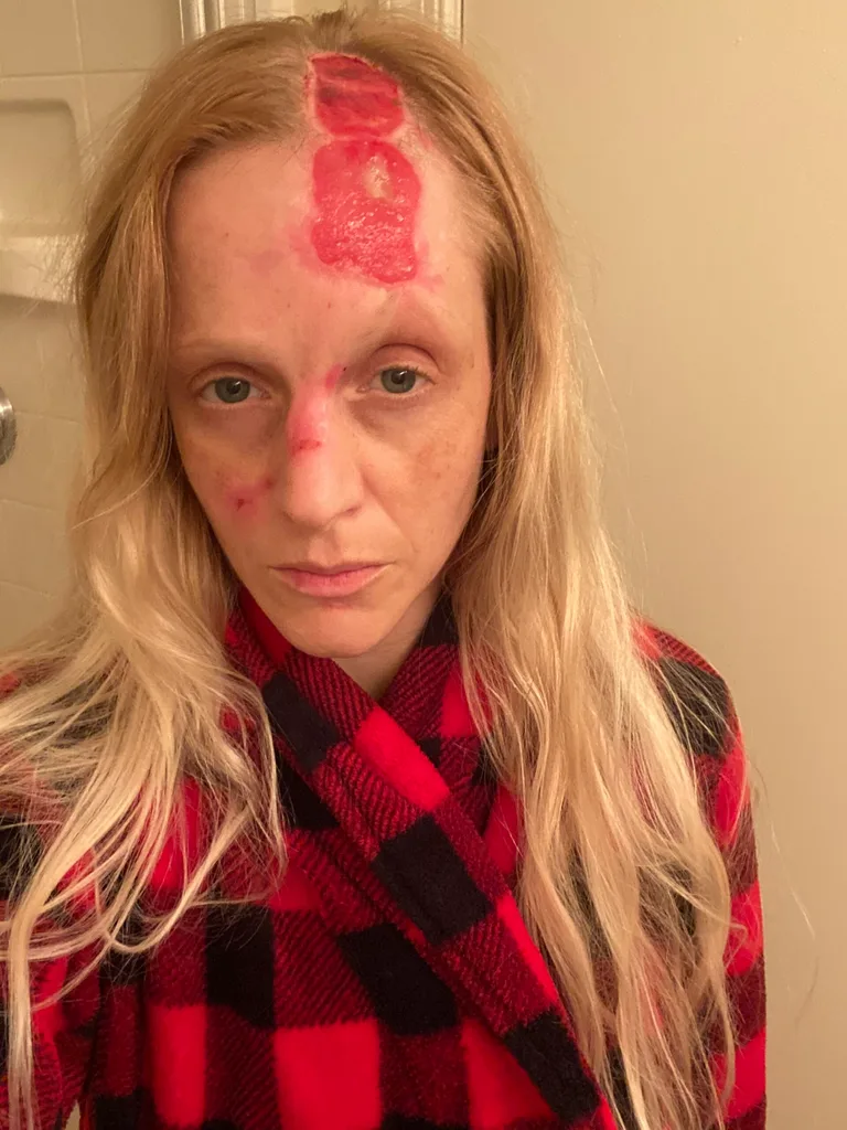 Image of womans injuries