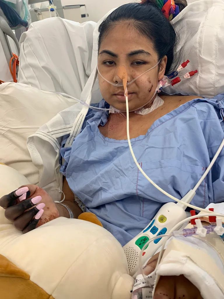 woman in blue hospital bed covered with tubes in hospital