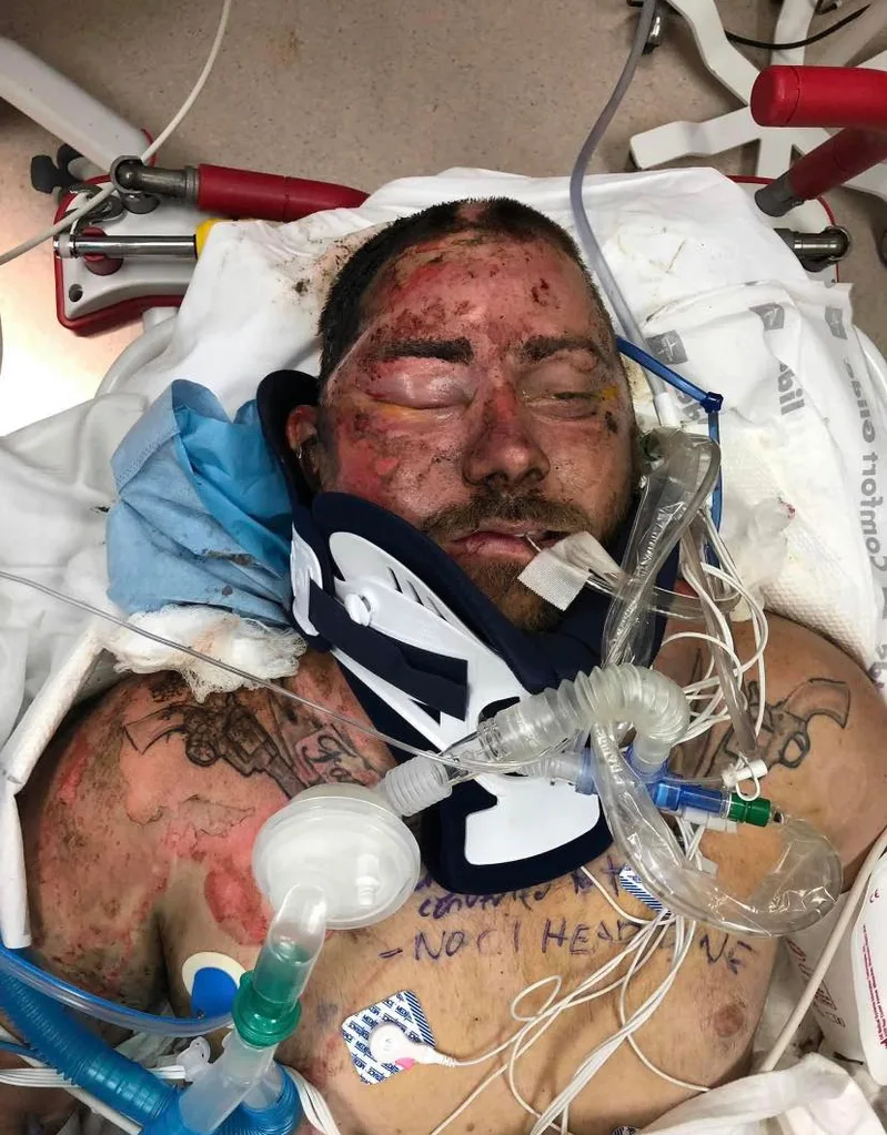John in hospital after being electrocuted.