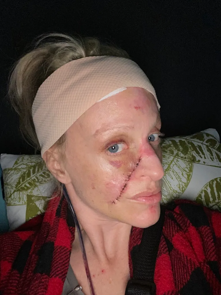 Image of womans scar