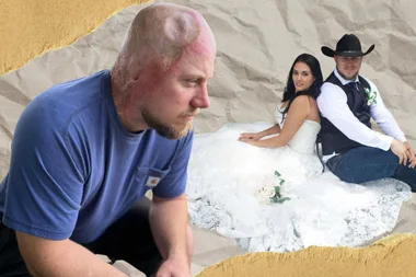 A collage of John before and after his freak accident. The first picture is of him and the burns on his head and body from the electric shock. The second picture is John and Tiffany on their wedding day before the electric shock.