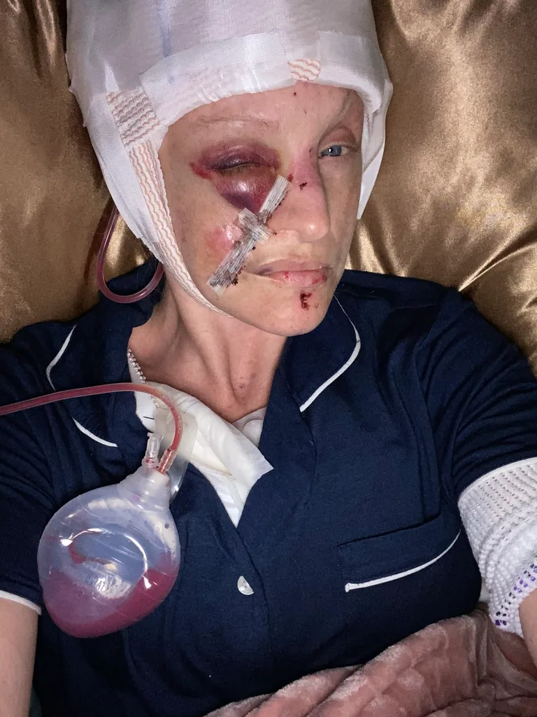 Image of woman after surgery