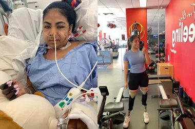 Blood poisoning shock: ‘We have to take your legs to save your life’