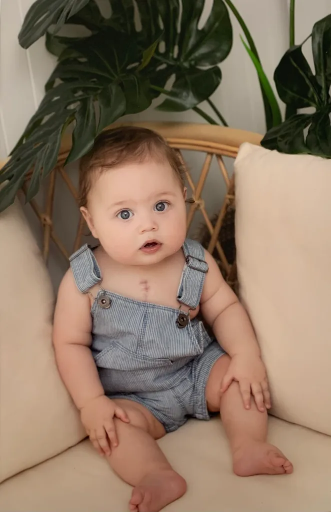 A baby boy dressed in blue overalls, you can see a chest scar peeking out.