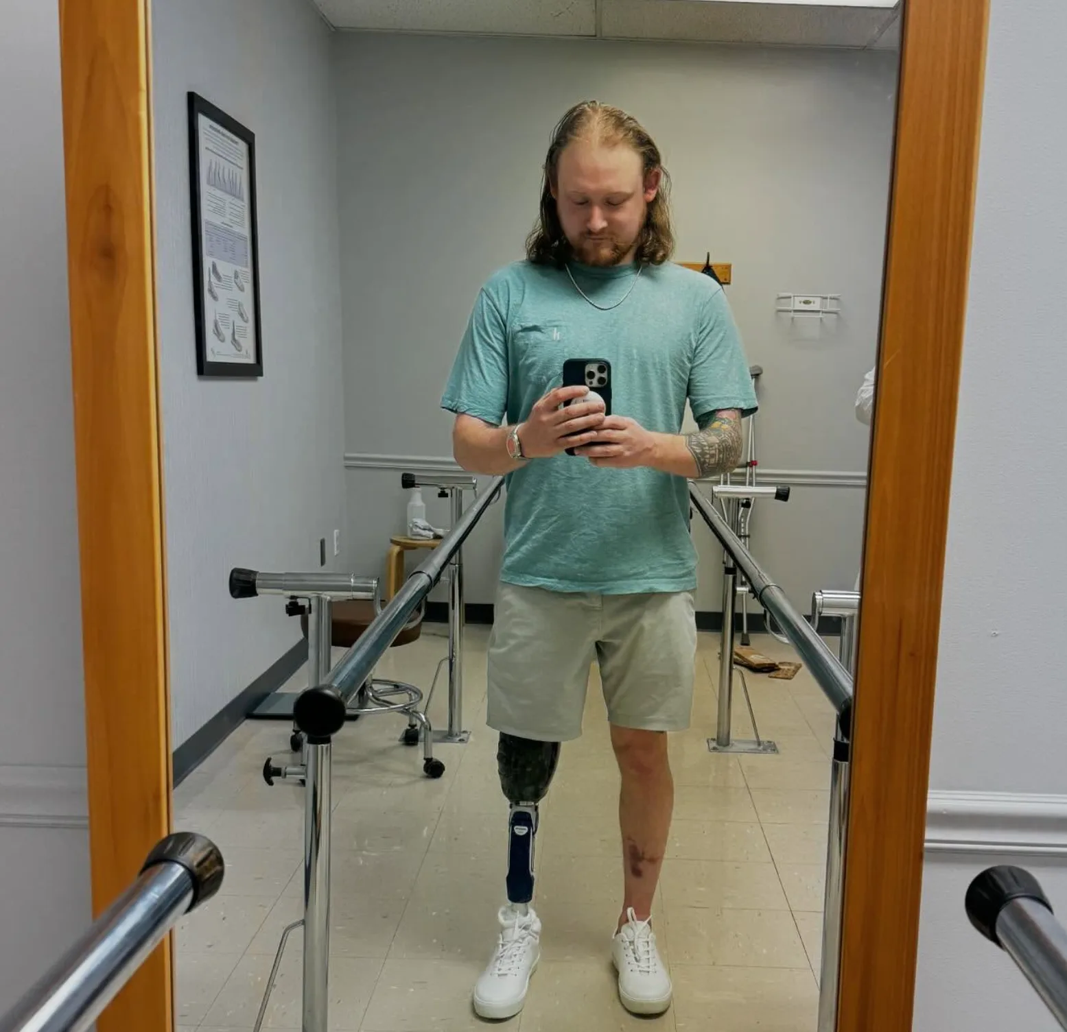 man with prosthetic leg. He is wearing a teal shirt and beige shorts