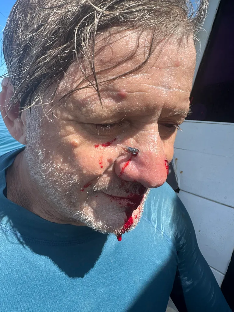 man in blue top with white beard and hair. A needle-nose fish has pierced his nose and blood is dripping from the wound