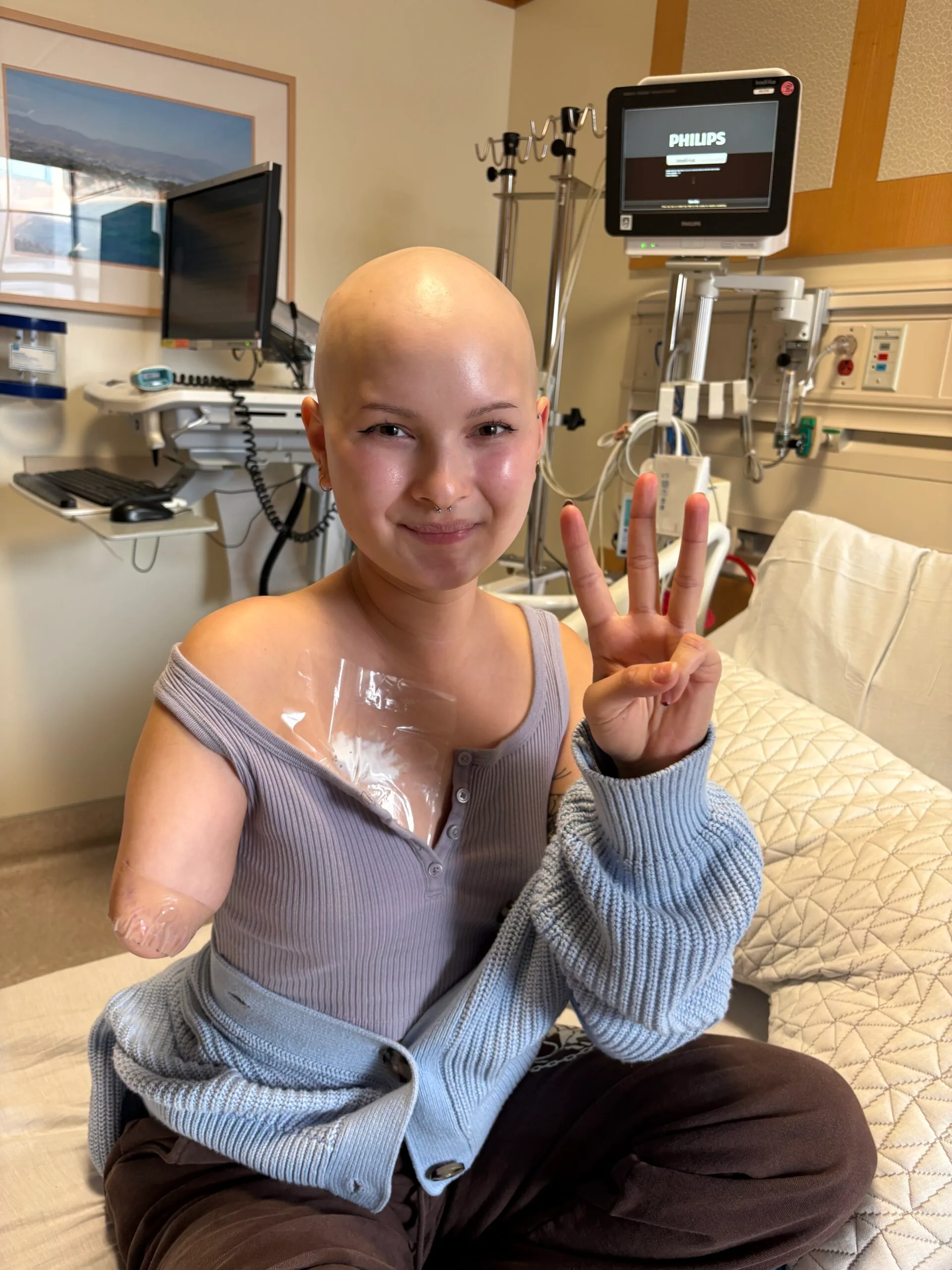 Young girl is wearing a grey singlet top. She has lost her hair and her right arm has been amputated above the elbow