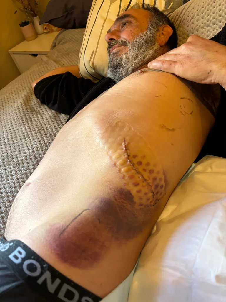 Image of mans stomach sliced open