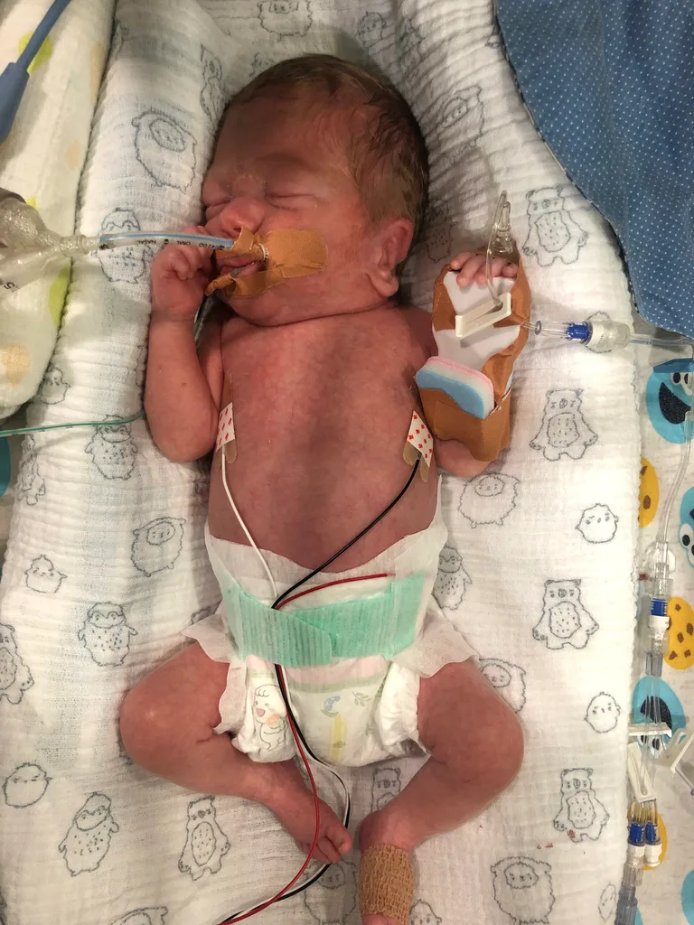 Image of baby in the hospital NICU