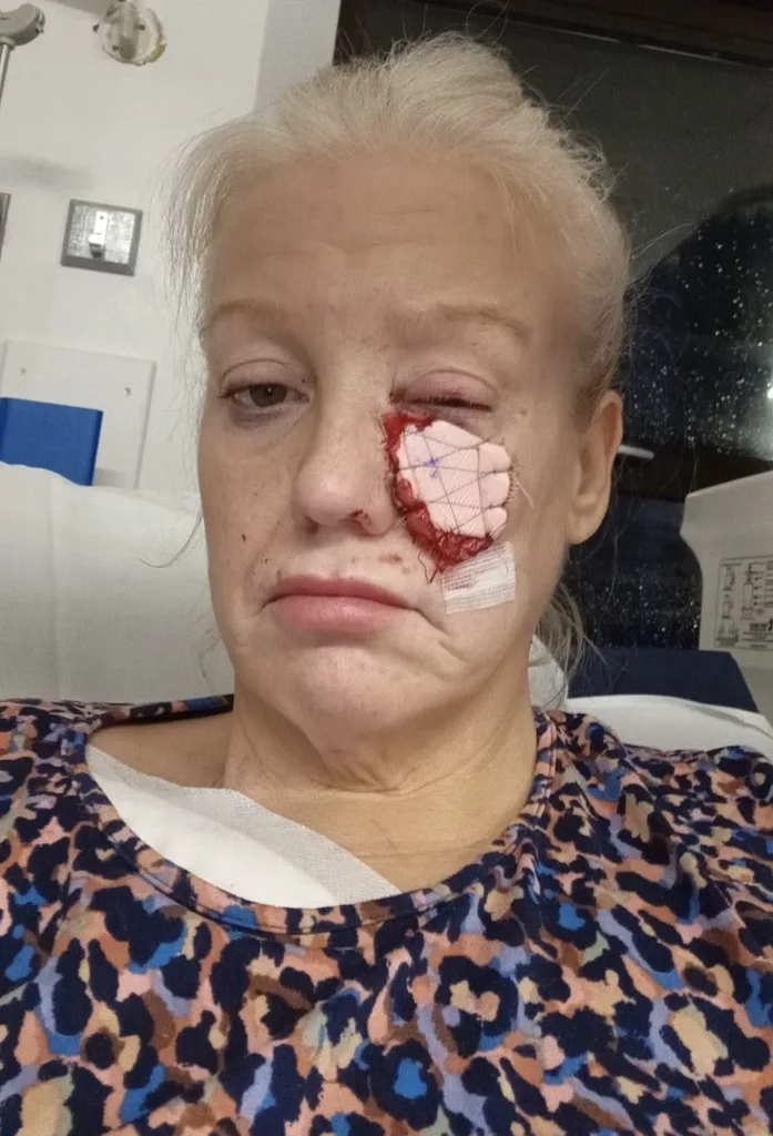 Image of woman om hospital after sausage dog attack