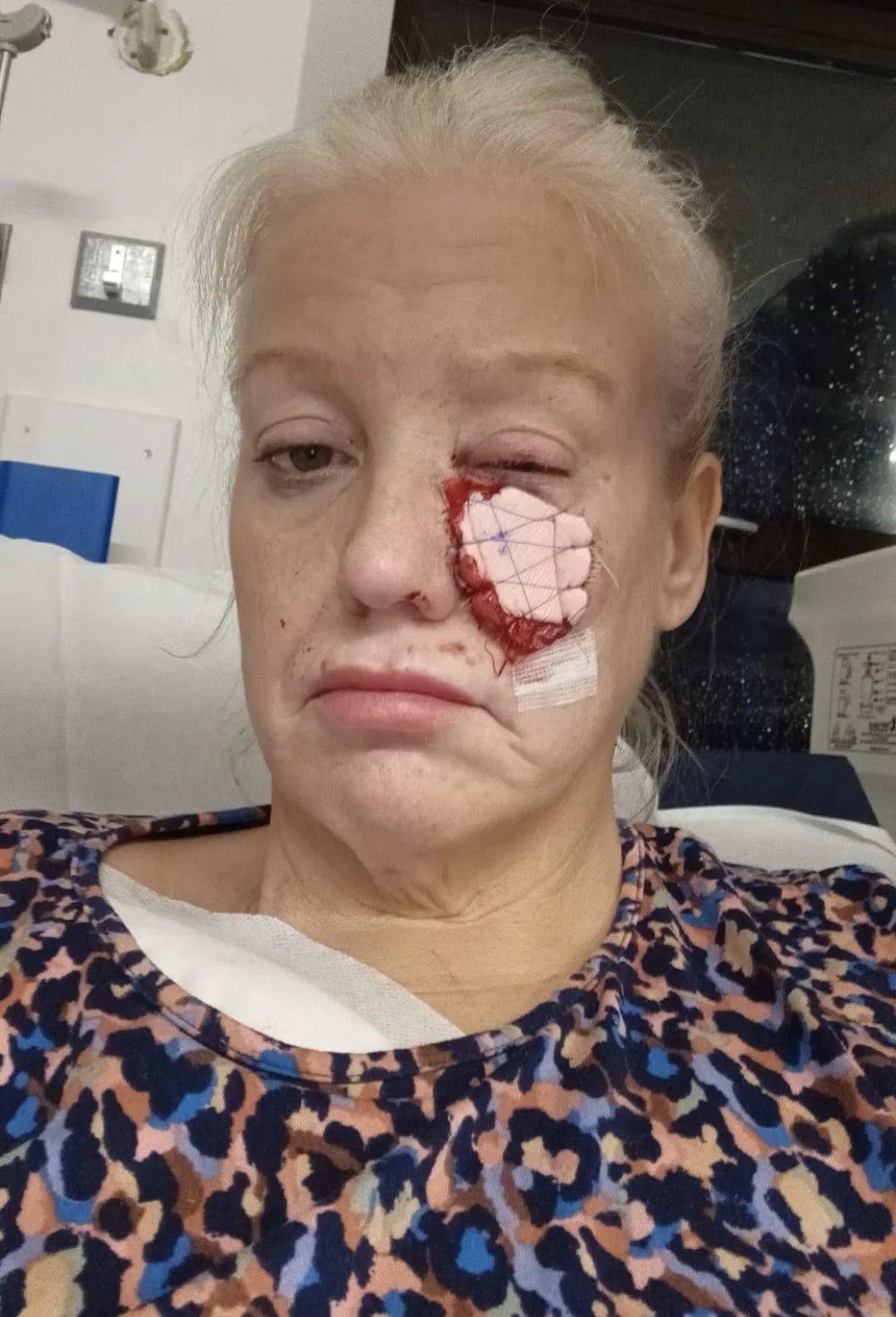 Image of woman om hospital after sausage dog attack