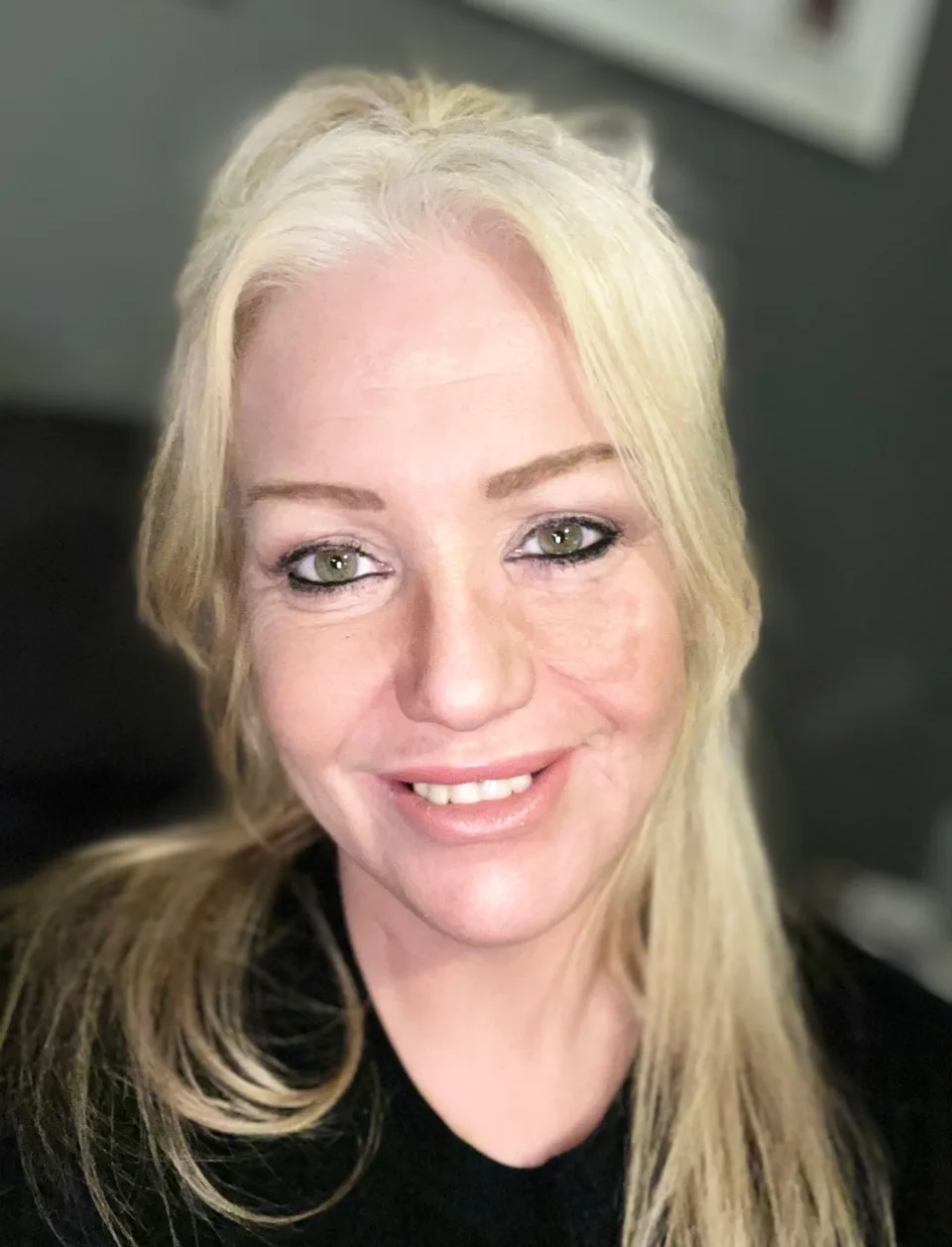 Image of woman in recovery from sausage dog attack