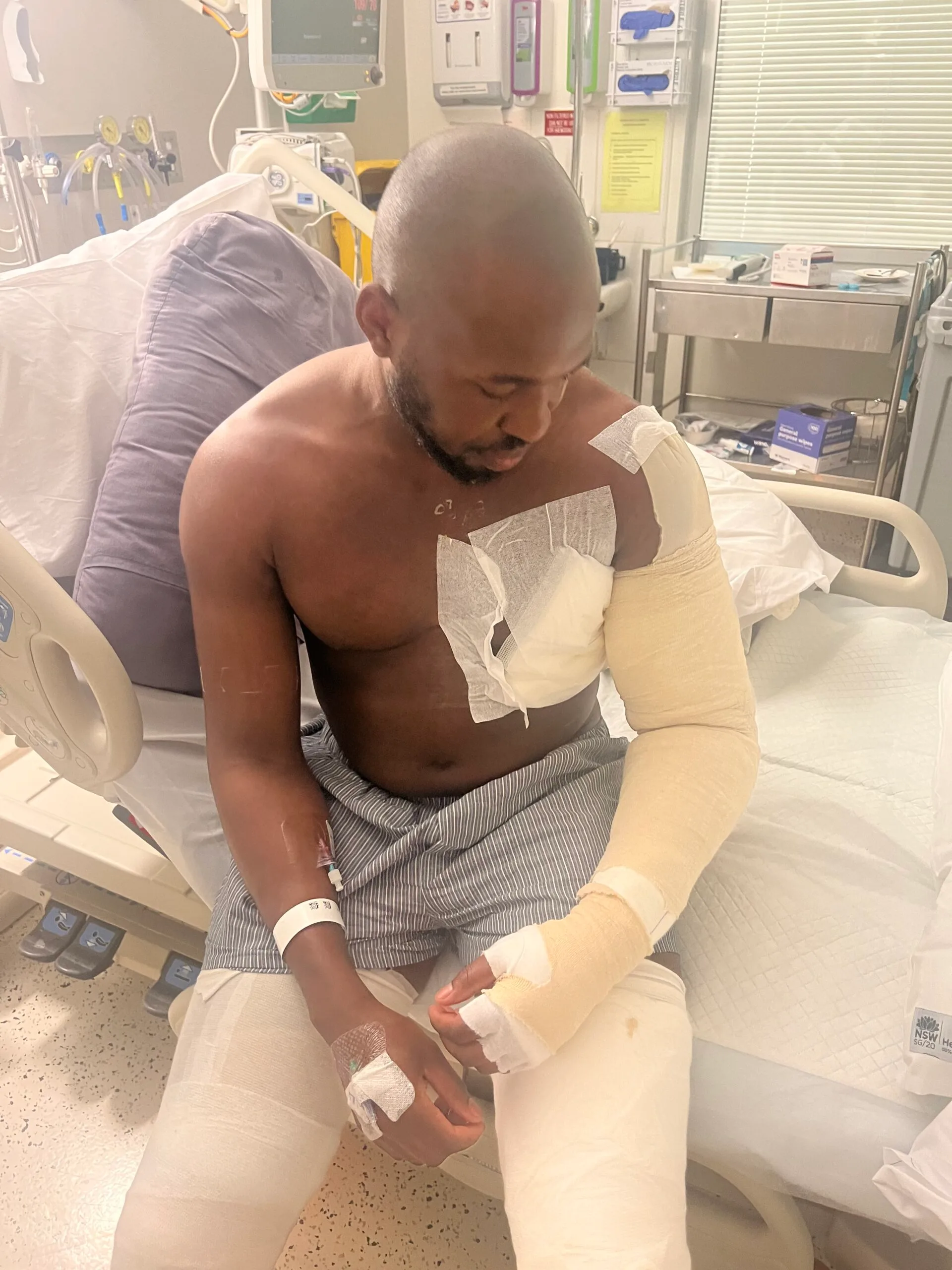 Image of man in hospital with bandages after being burned alive