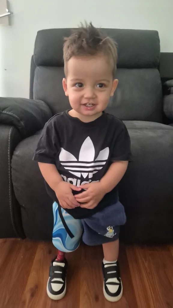Image of young boy wearing black t-shirt and wearing leg prosthetic